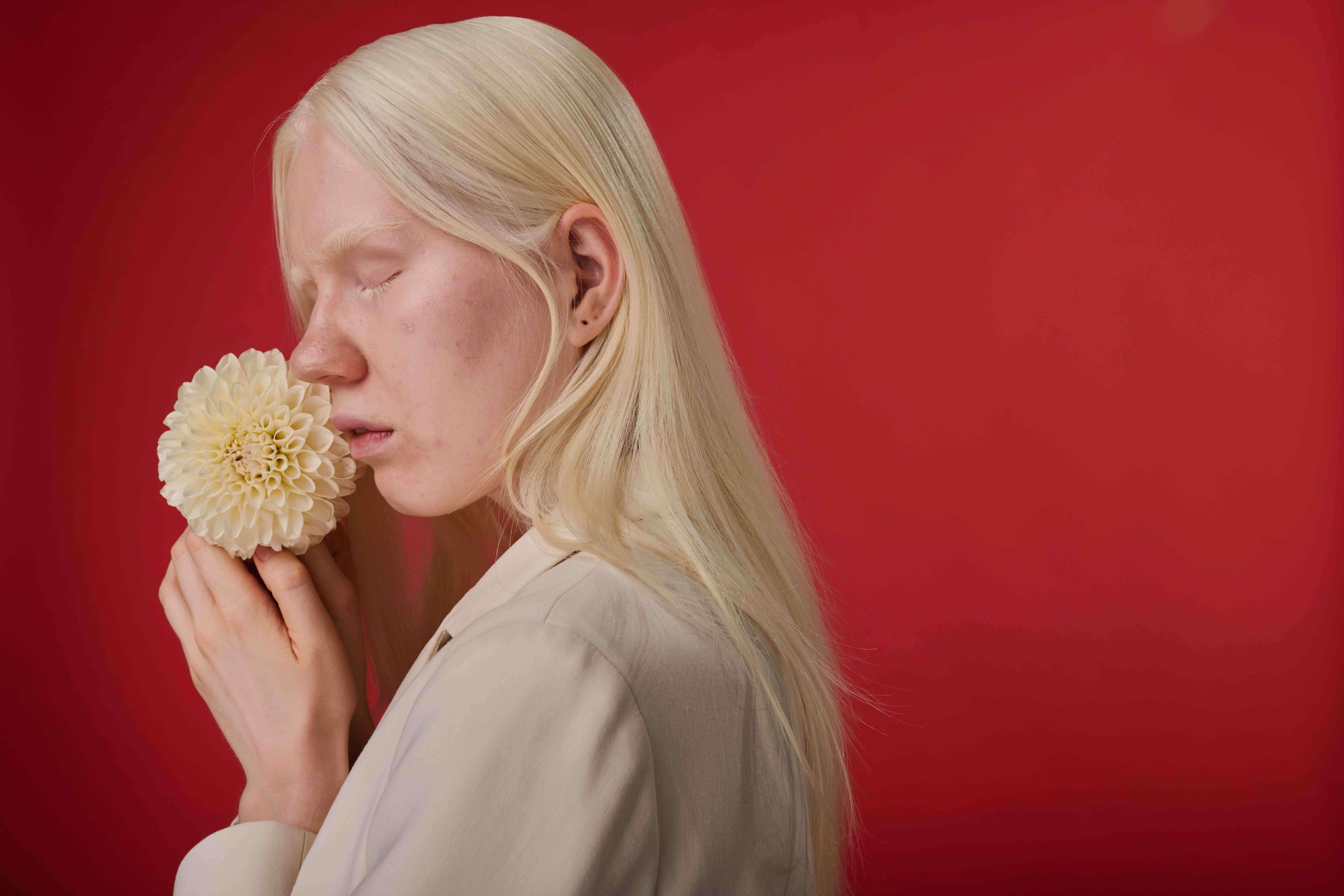 Fille albinos posant avec une fleur